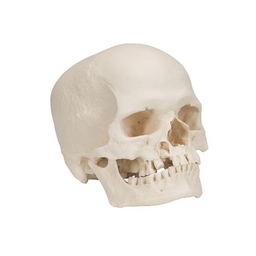 이상 소두 (小頭) 두개골 모형, 1000065 [A29/1], 두개골 모형