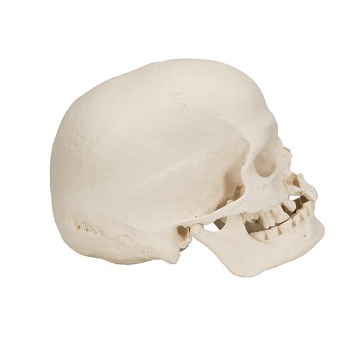 이상 소두 (小頭) 두개골 모형, 1000065 [A29/1], 두개골 모형