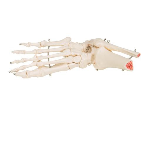 Squelette du pied avec moignon tibia et fibula (péroné), sur fil de fer, côté - 3B Smart Anatomy, 1019357 [A31], Modèles de squelettes des membres inférieurs