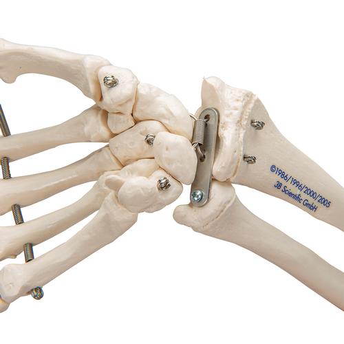 Esqueleto da M&atilde;o, com parte da ulna e do r&aacute;dio, montado em arame, 1019370 [A41], Modelos de esqueletos do bra&ccedil;o e m&atilde;o