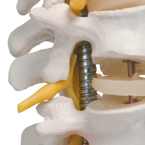 Colonna vertebrale flessibile molto robusta - 3B Smart Anatomy, 1000130 [A59/1], Modelli di Colonna Vertebrale