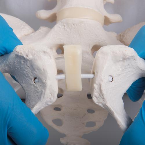 灵活安装的女性骨盆，带股骨头 - 3B Smart Anatomy, 1019865 [A62/1], 生殖和骨盆模型