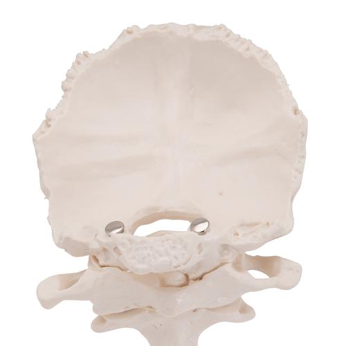 후두부를 포함한 환추, 축추 모형 Atlas and Axis, with occipital plate - 3B Smart Anatomy, 1000142 [A71/5], 척추뼈 모형