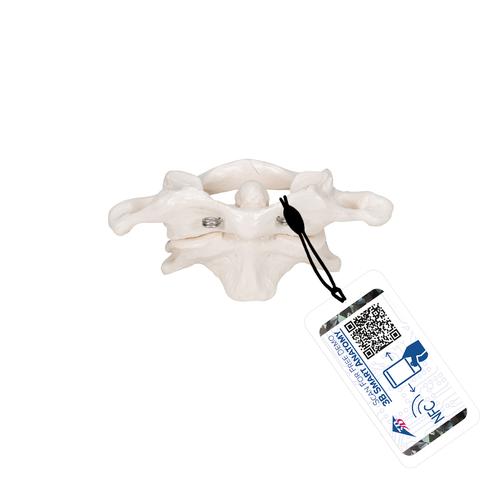 环椎和枢椎组合，无基架 - 3B Smart Anatomy, 1000140 [A71], 独立的骨模型