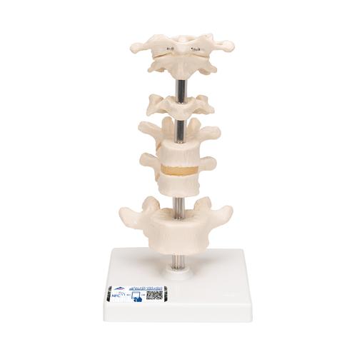 Model of 6 Human Vertebrae, Mounted on Stand (atlas, axis, cervical, 2x thoracic, lumbar)  - 3B Smart Anatomy, 1000147 [A75], Vertebra Models