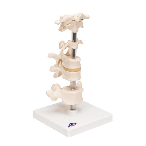 Model of 6 Human Vertebrae, Mounted on Stand (atlas, axis, cervical, 2x thoracic, lumbar) - 3B Smart Anatomy, 1000147 [A75], Vertebra Models