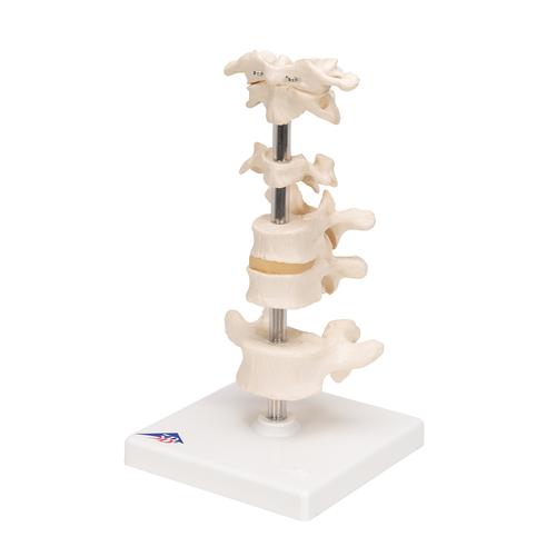 6 분리 척추 모형 Model of 6 Human Vertebrae, Mounted on Stand (atlas, axis, cervical, 2x thoracic, lumbar) - 3B Smart Anatomy, 1000147 [A75], 척추뼈 모형