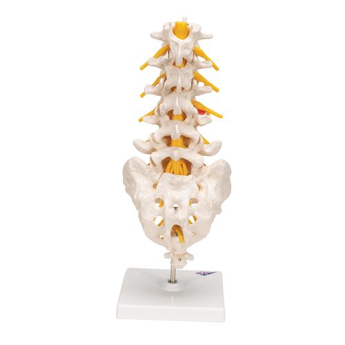 Columnavertebral lumbar con hernia discal dorsolateral - 3B Smart Anatomy, 1000150 [A76/5], Modelos de vértebras