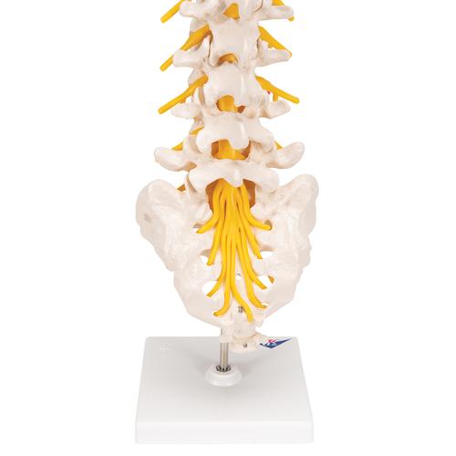 Human Lumbar Spinal Column Model with Dorso-Lateral Prolapsed Intervertebral Disc - 3B Smart Anatomy, 1000150 [A76/5], Vertebra Models