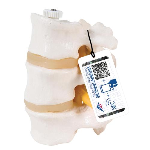 3块腰椎，活动安装 - 3B Smart Anatomy, 1000151 [A76/8], 脊椎模型