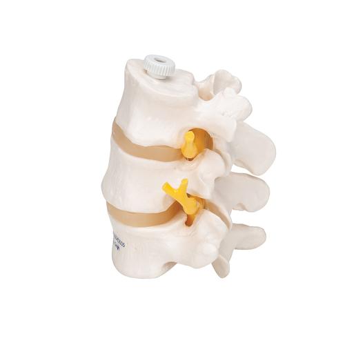 3 vertebre lombari, montaggio elastico - 3B Smart Anatomy, 1000151 [A76/8], Modelli di vertebre