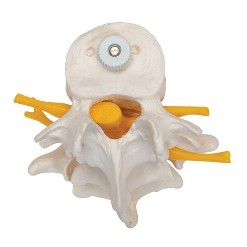 Tres discos vertebrales, montados flexibles - 3B Smart Anatomy, 1000151 [A76/8], Modelos de vértebras