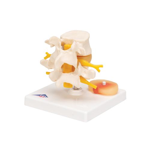 &Aacute;gy&eacute;ki gerincoszlop porckorongs&eacute;rvvel, 1000149 [A76], Csigolyamodellek