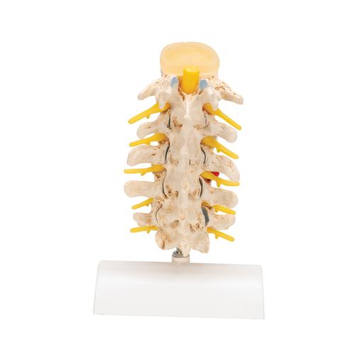 Estadios del prolapso del cartílago interventeral y de la degeneración vertebral - 3B Smart Anatomy, 1000158 [A795], Modelos de vértebras