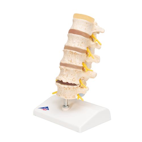 椎间盘脱垂及脊椎退行性变模型 - 3B Smart Anatomy, 1000158 [A795], 脊椎模型