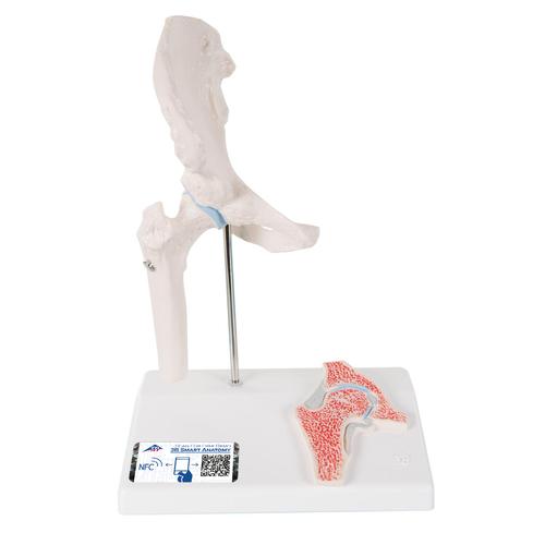 Mini Anatomie Modell H&uuml;ftgelenk, mit Querschnitt, 1000168 [A84/1], Gelenkmodelle