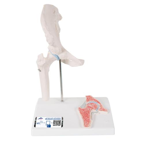 Мини-модель тазобедренного сустава с поперечным сечением - 3B Smart Anatomy, 1000168 [A84/1], Модели суставов, кисти и стопы человека
