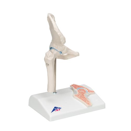 Mini Anatomie Modell Hüftgelenk, mit Querschnitt - 3B Smart Anatomy, 1000168 [A84/1], Gelenkmodelle