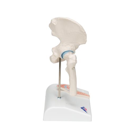 Mini Anatomie Modell H&uuml;ftgelenk, mit Querschnitt, 1000168 [A84/1], Gelenkmodelle