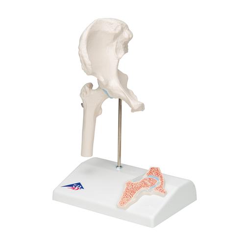 Mini-articulación de la cadera con corte transversal, sobre una base - 3B Smart Anatomy, 1000168 [A84/1], Modelos de Articulaciones