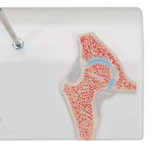 Mini Anatomie Modell H&uuml;ftgelenk, mit Querschnitt, 1000168 [A84/1], Gelenkmodelle