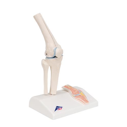 관절 단면이 포함된 소형(미니) 무릎 관절(슬관절) 모형 Mini Human Knee Joint Model with Cross Section - 3B Smart Anatomy, 1000170 [A85/1], 관절 모형