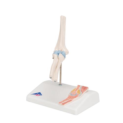 관절 단면이 포함된 소형(미니) 팔꿈치 관절(주관절) 모형 Mini Human Elbow Joint Model with Cross Section - 3B Smart Anatomy, 1000174 [A87/1], 관절 모형