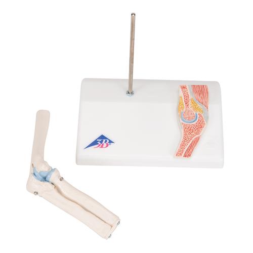 관절 단면이 포함된 소형(미니) 팔꿈치 관절(주관절) 모형 Mini Human Elbow Joint Model with Cross Section - 3B Smart Anatomy, 1000174 [A87/1], 관절 모형