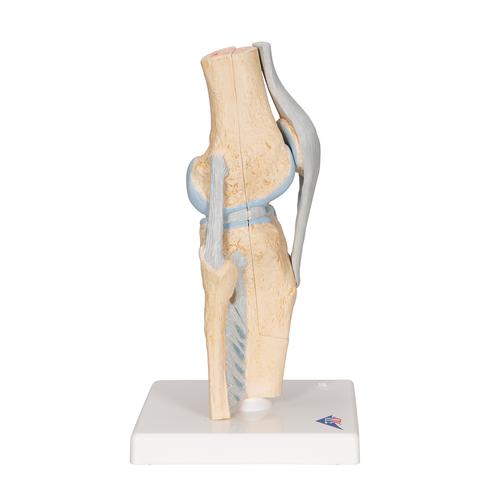 무릎관절 단면모형 3 파트 분리 Sectional Knee Joint Model, 3 part - 3B Smart Anatomy, 1000180 [A89], 관절 모형