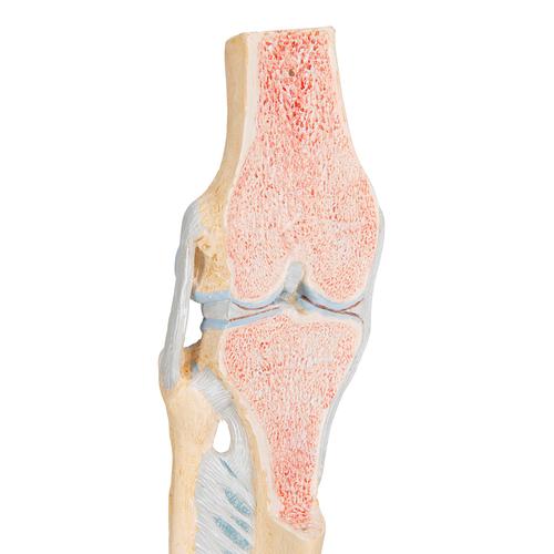 膝关节切面模型，3部分组成 - 3B Smart Anatomy, 1000180 [A89], 关节模型