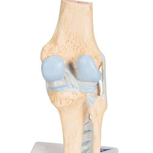 Модель коленного сустава в разрезе - 3B Smart Anatomy, 1000180 [A89], Модели суставов, кисти и стопы человека