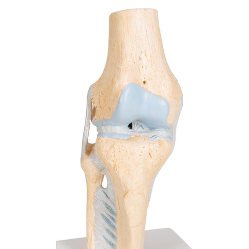 Modèle de coupe de l'articulation du genou, en 3 parties - 3B Smart Anatomy, 1000180 [A89], Modèles d'articulations