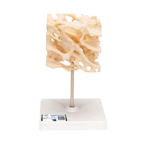Модель губчатой кости - 3B Smart Anatomy, 1009698 [A99], Модели отдельных костей