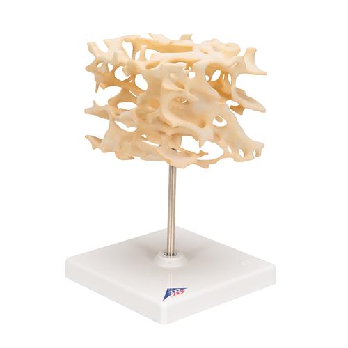 松质骨模型, 1009698 [A99], 微观解剖模型。