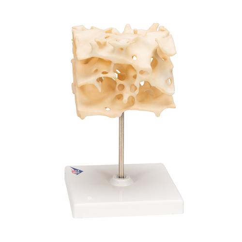 松质骨模型, 1009698 [A99], 独立的骨模型