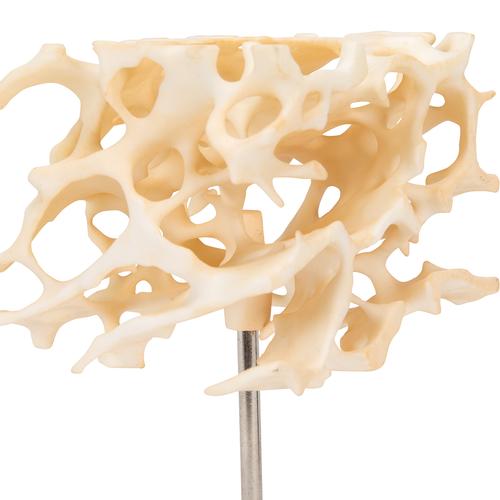 Модель губчатой кости - 3B Smart Anatomy, 1009698 [A99], Модели отдельных костей