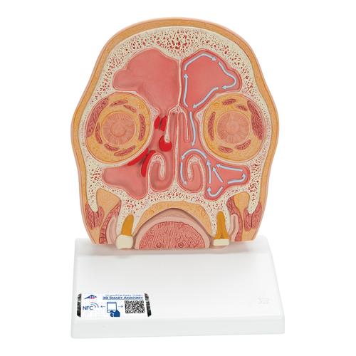 Kopfmodell frontal geschnitten in anatomischer H&ouml;he der Nasennebenh&ouml;hlen (mit Sinusitis), 1012789 [C13/1], Kopfmodelle