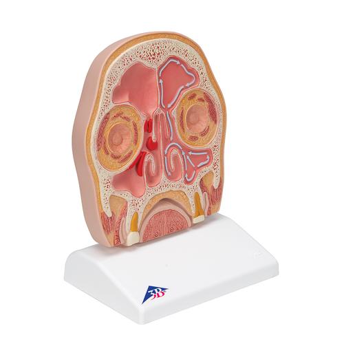 Kopfmodell frontal geschnitten in anatomischer H&ouml;he der Nasennebenh&ouml;hlen (mit Sinusitis), 1012789 [C13/1], Kopfmodelle