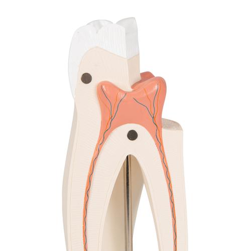 Upper Triple-Root Molar Human Tooth Model, 3 part - 3B Smart Anatomy, 1017580 [D10/5], Dental Models