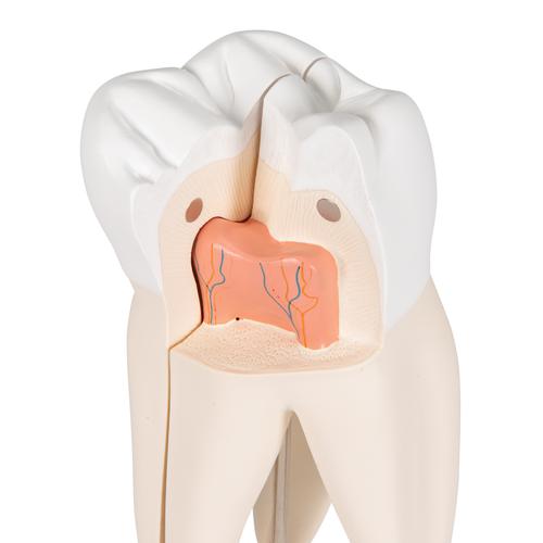 Upper Triple-Root Molar Human Tooth Model, 3 part - 3B Smart Anatomy, 1017580 [D10/5], Dental Models