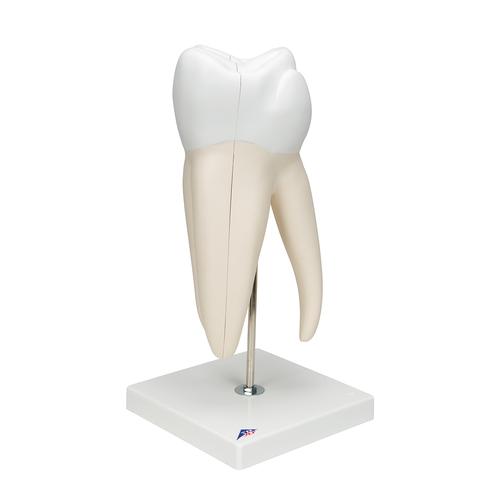 大臼齿，带龋，6部分 - 3B Smart Anatomy, 1013215 [D15], 牙齿模型