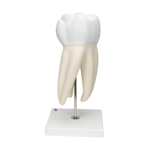 Гигантская модель моляра, пораженного кариесом, 15-кратное увеличение, 6 частей - 3B Smart Anatomy, 1013215 [D15], Модели зубов