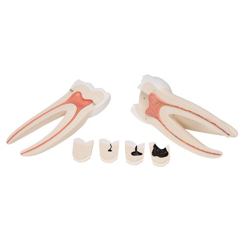 Anatomical Teaching Models - Plastic Human Dental Models - Giant