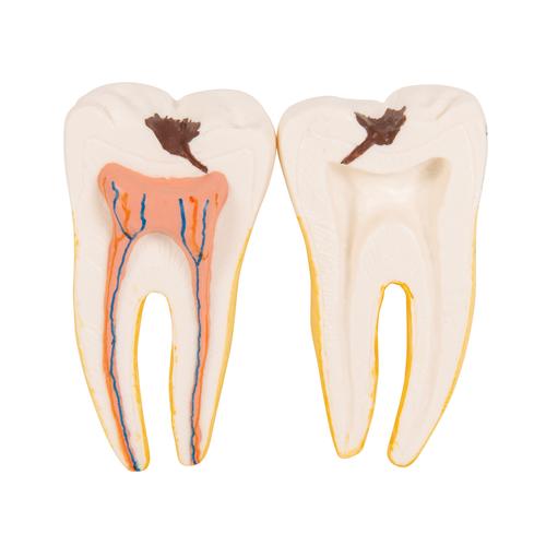 半下颌，实物3倍，6部分 - 3B Smart Anatomy, 1000249 [D25], 牙齿模型