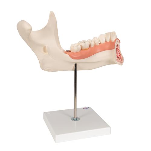 하악 절반 모형 Half Lower Jaw, 3 times full-size, 6 part - 3B Smart Anatomy, 1000249 [D25], 치아 모형