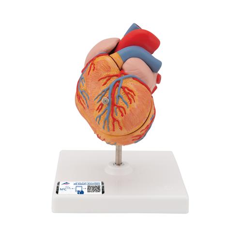 Cœur classique avec hypertrophie du ventricule gauche (HVG), en 2 parties - 3B Smart Anatomy, 1000261 [G04], Modèles cœur et circulation
