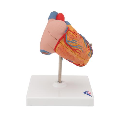 Herzmodell "Klassik" mit linksventrikulärer Hypertrophie (LVH), 2-teilig - 3B Smart Anatomy, 1000261 [G04], Herz- und Kreislaufmodelle