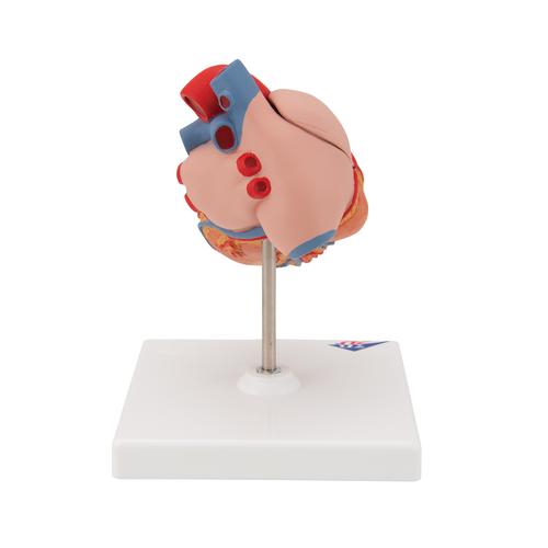 C&oelig;ur classique avec hypertrophie du ventricule gauche (HVG), en 2 parties, 1000261 [G04], Mod&egrave;les c&oelig;ur et circulation