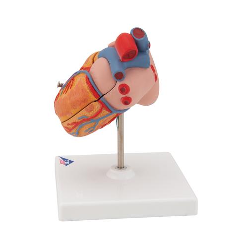 C&oelig;ur classique avec hypertrophie du ventricule gauche (HVG), en 2 parties, 1000261 [G04], Mod&egrave;les c&oelig;ur et circulation