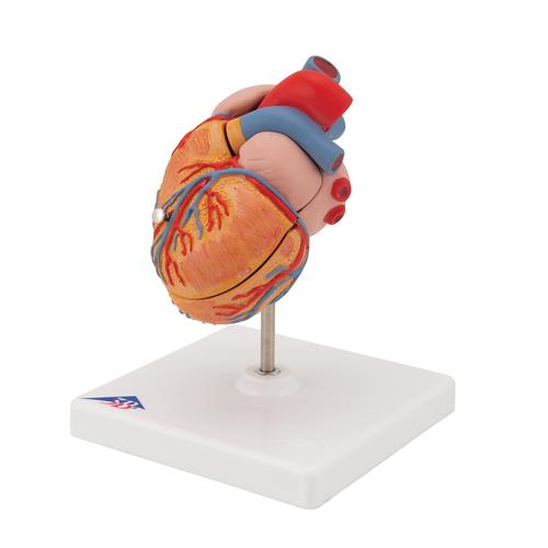 C&oelig;ur classique avec hypertrophie du ventricule gauche (HVG), en 2 parties, 1000261 [G04], Mod&egrave;les c&oelig;ur et circulation